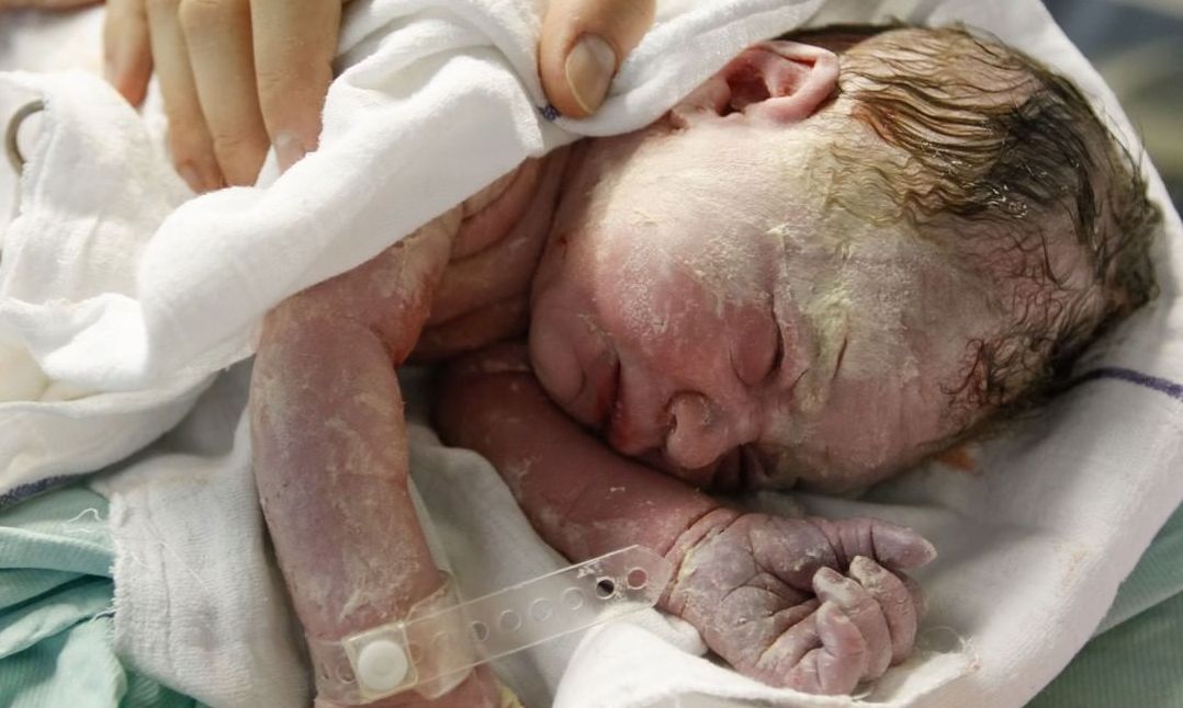 Vernix caseosa: Μωράκια φωτογραφίζονται έχοντας πάνω τους αυτή τη θαυματουργή ουσία (pics)