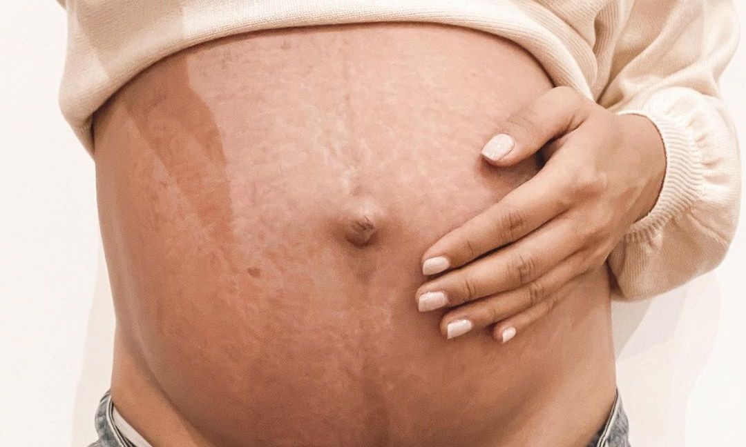 «Αγαπημένες μαμάδες που γεννήσατε με καισαρική σταματήστε να νιώθετε ενοχές»