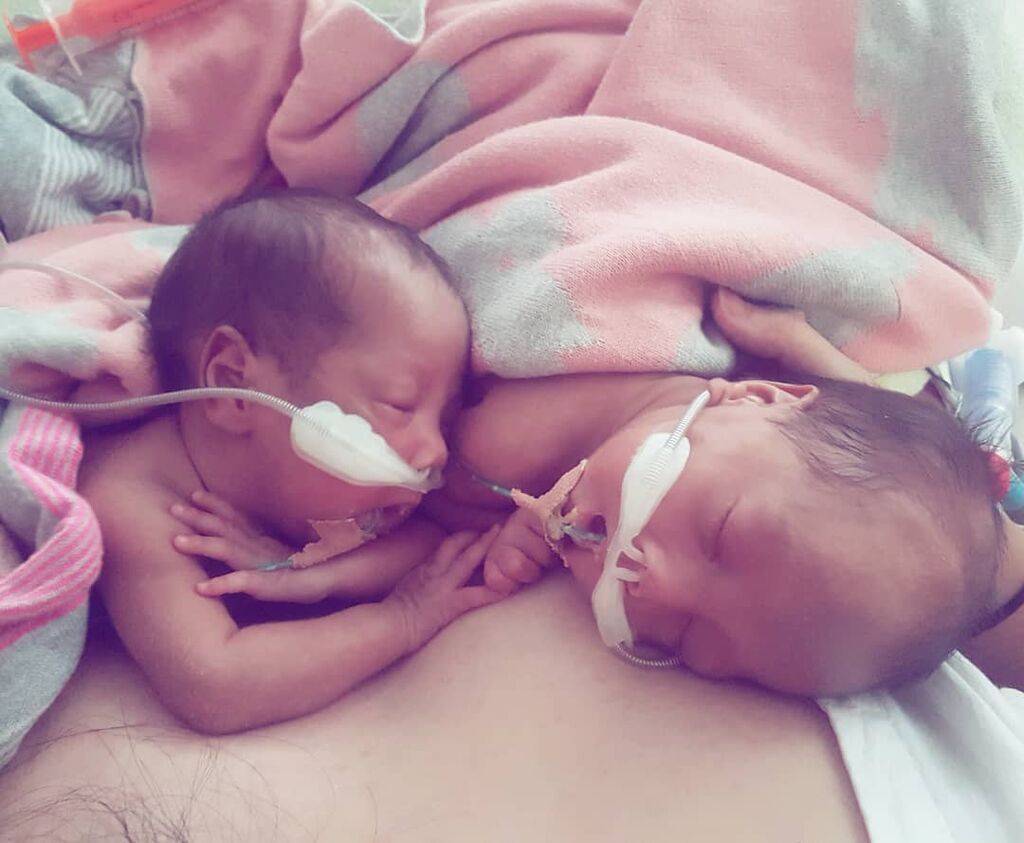 Η συγκινητική φωτογραφία με τα πρόωρα δίδυμα που κάνει το γύρο του διαδικτύου (pics)