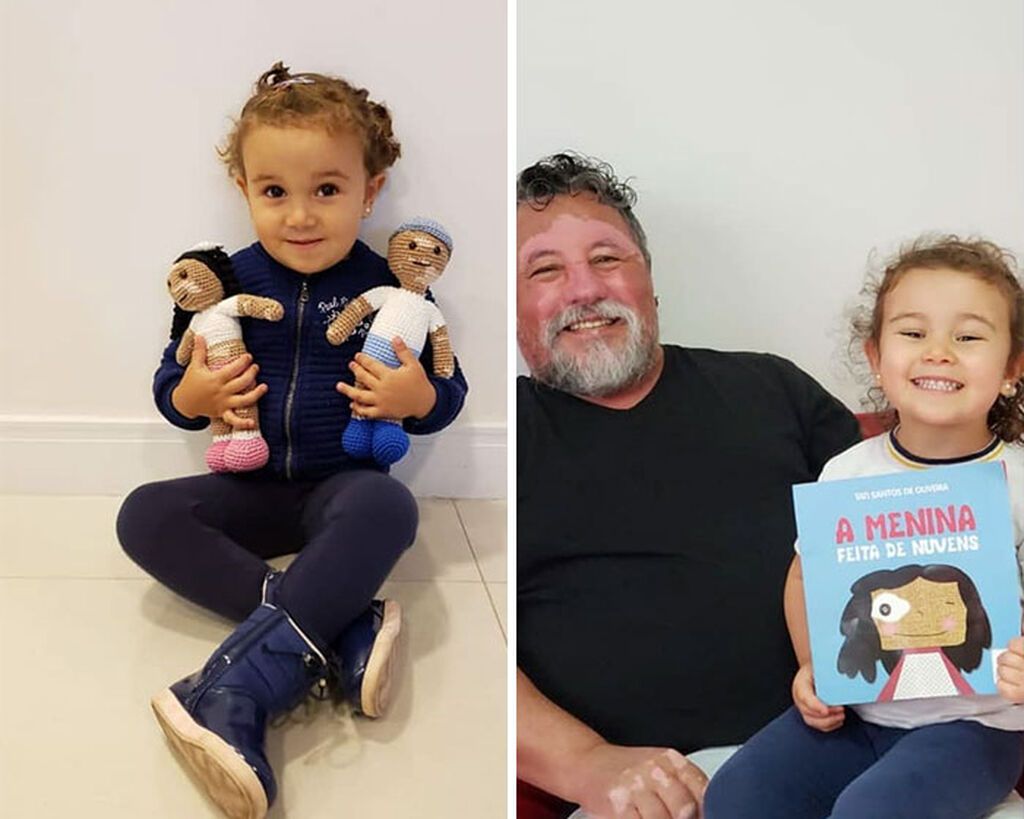 Παππούς που πάσχει από λεύκη δημιουργεί τις πιο εντυπωσιακές κούκλες για ομοιοπαθή παιδιά (pics)
