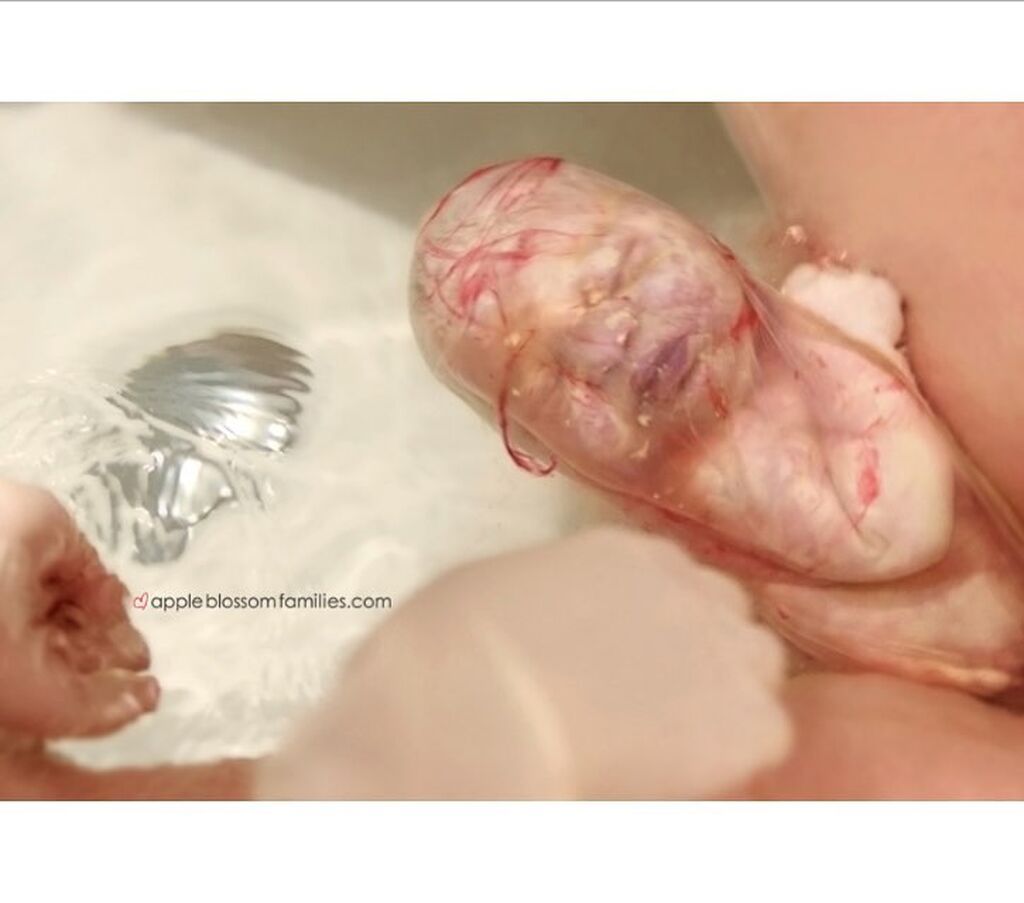 πηγή φωτογραφίας: Instagram account @birthphotographer