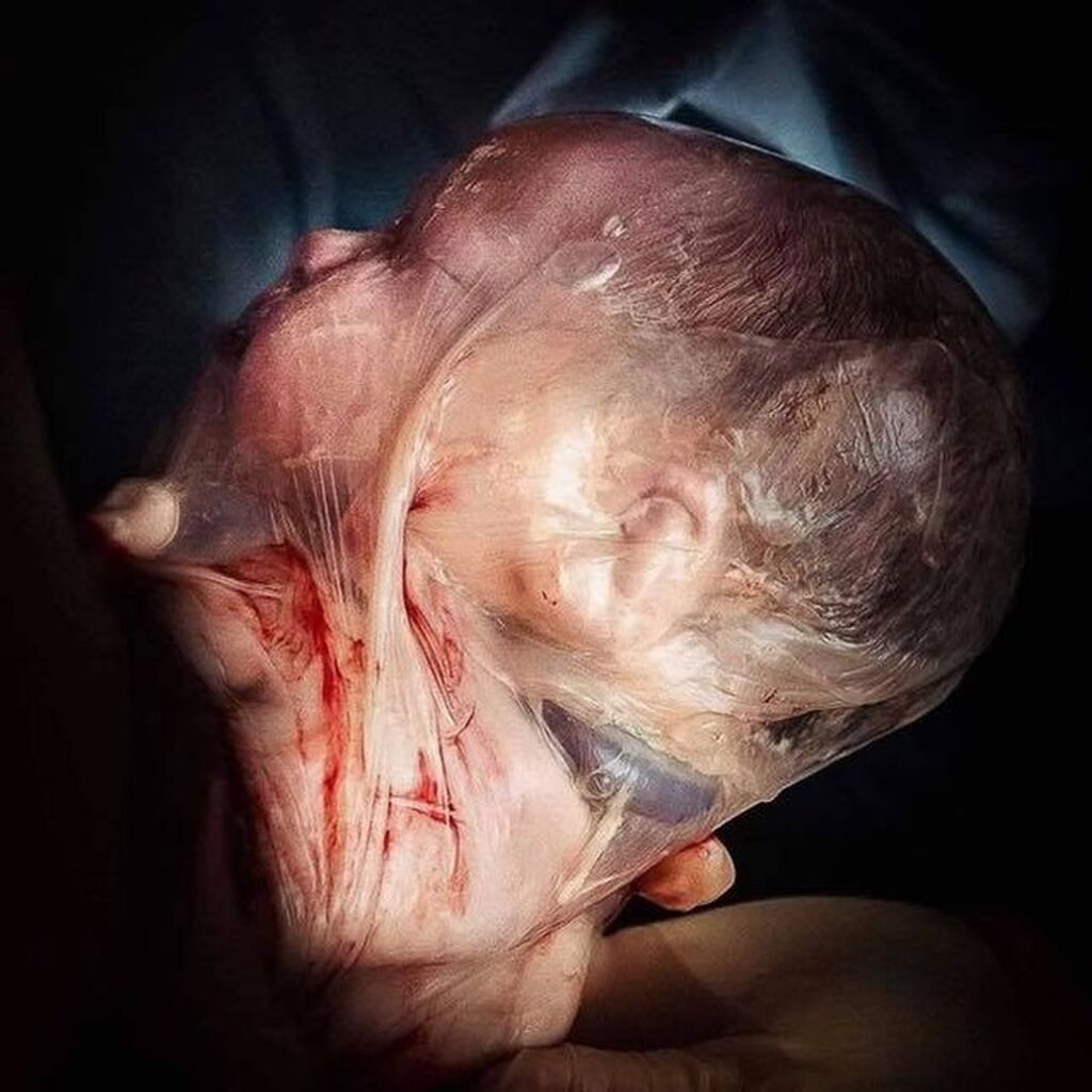 πηγή φωτογραφίας: Instagram account @aboutbirthonline