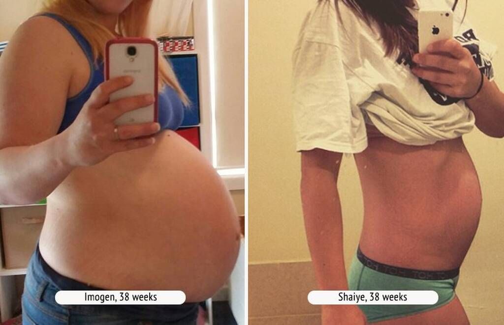 Bump shaming: Yπάρχει και πρέπει να σταματήσει αμέσως (εικόνες)