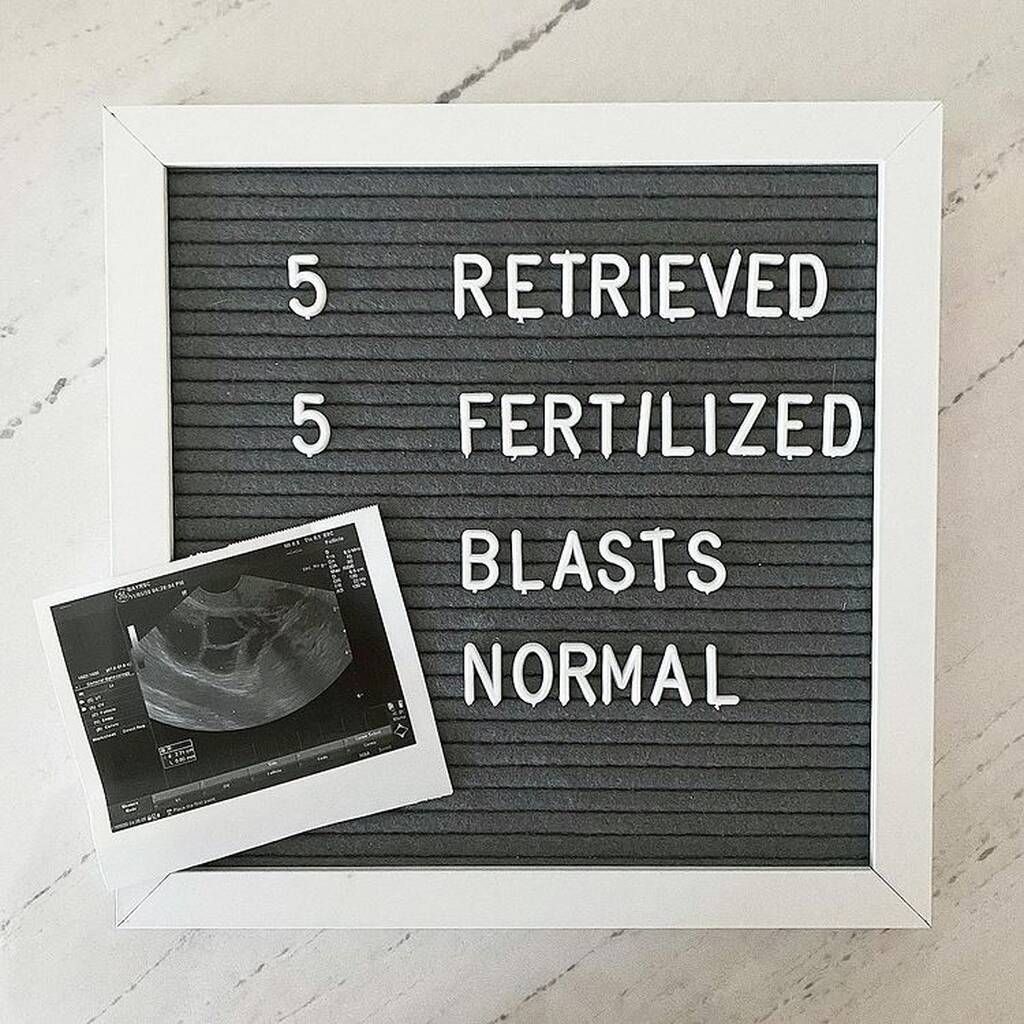 Instagram @waitingforbabywunder