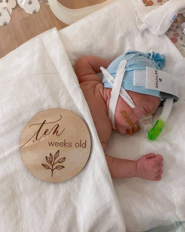 Πηγή φωτογραφίας: Instagram / aimz13r_