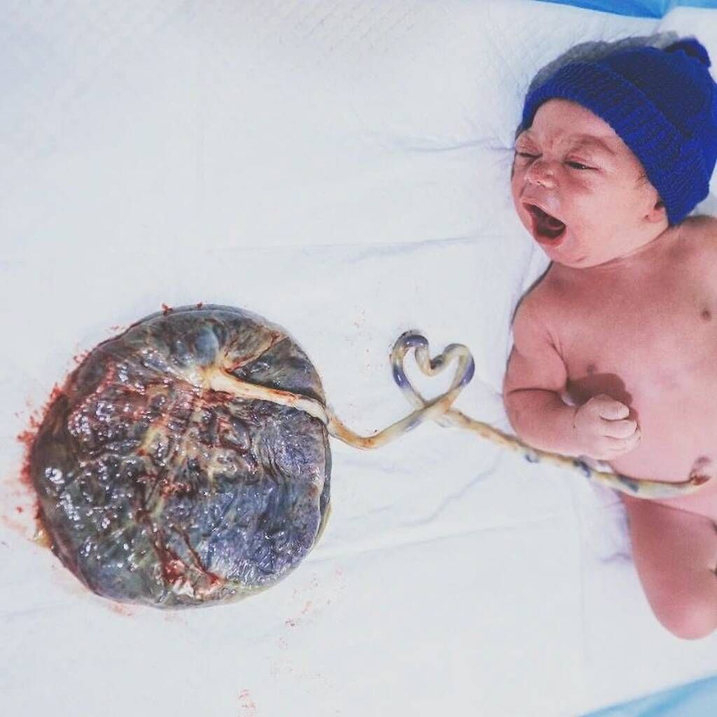 Πηγή φωτογραφίας: Instagram / keniamelofotografia_infantil