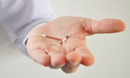 Πώς και πότε ο γυναικολόγος εισάγει το ενδομήτριο σπείραμα (σπιράλ);