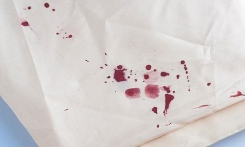 Δεν πάει ο νους σας με τι αφαιρείται ο λεκές από αίμα!