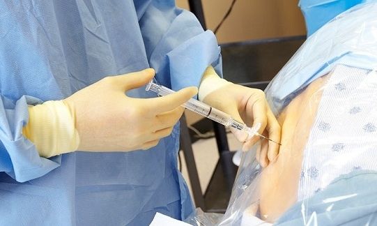 Ο γυναικολόγος του Mothersblog μας ενημερώνει για την επισκληρίδιο αναισθησία στον τοκετό!