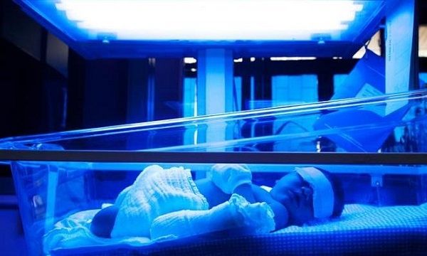 Επιστήμονες κατασκεύασαν "έξυπνα" ρούχα για πρόωρα μωρά (βίντεο)