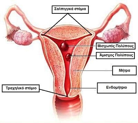 IMAGE1GYN