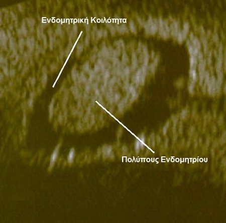 IMAGE2GYN