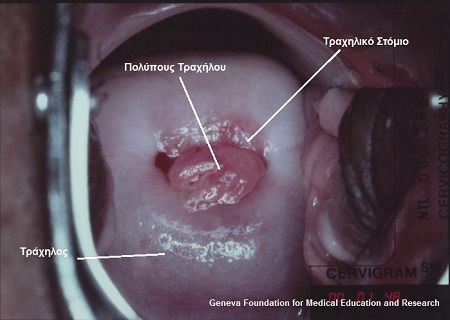 IMAGE3GYN