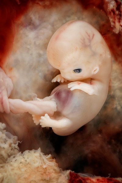 7 8 week old fetus 9 10 week pregnancy