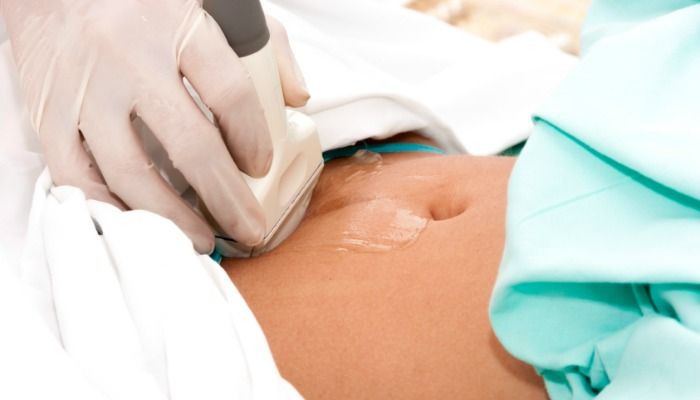 Ectopic Pregnancy