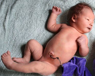 Lachlan 4th day lotus birth