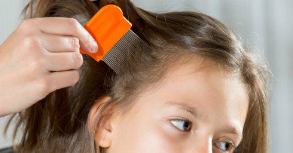 lice