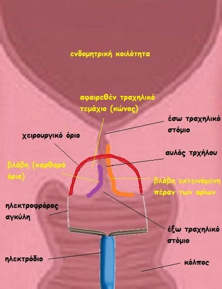 eikona 3