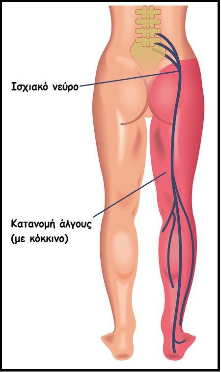 endomitriosi algous