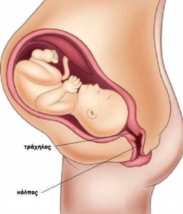inimioma1