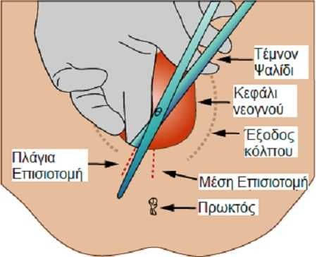 kolpos