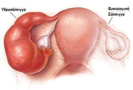 gonimotita5