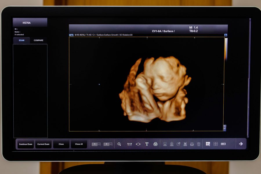 Image Ultrasound 3d Or 4d Of Baby In Mother's Womb. Picture 4d With Ultrasound Of Baby In Mother's W