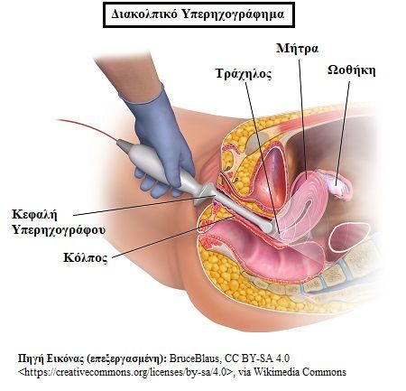 eminopavsi1.jpg