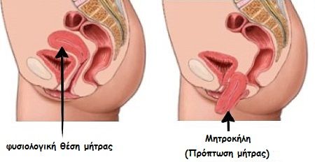 aima-meta-ton-toketo.jpg